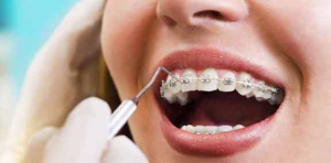 Dr. Burak Aksu, Ortodonti Uzmanı, Ortodontist